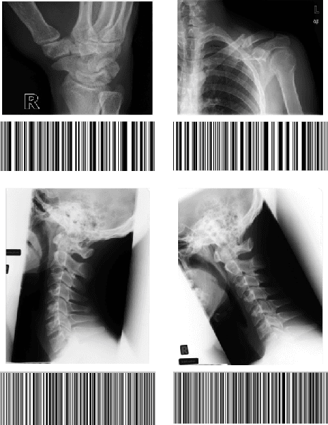 Figure 4 for Gabor Barcodes for Medical Image Retrieval
