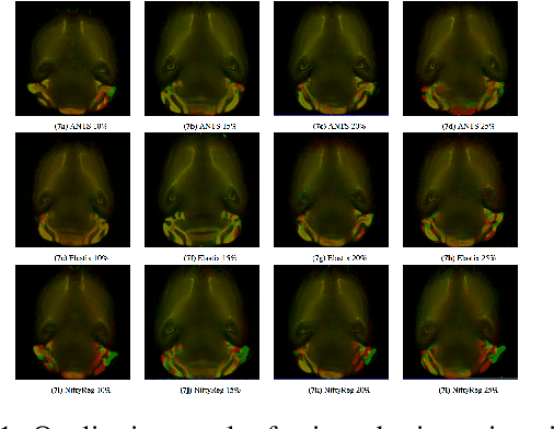 Figure 1 for Performance of Image Registration Tools on High-Resolution 3D Brain Images
