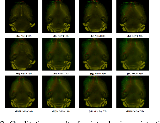 Figure 2 for Performance of Image Registration Tools on High-Resolution 3D Brain Images