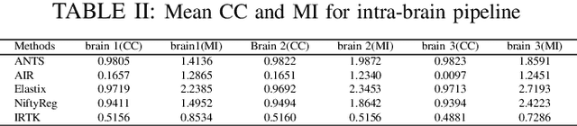 Figure 3 for Performance of Image Registration Tools on High-Resolution 3D Brain Images