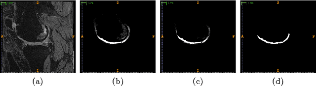 Figure 3 for Semantic Context Forests for Learning-Based Knee Cartilage Segmentation in 3D MR Images