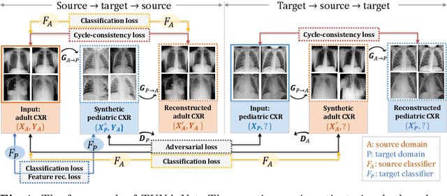 Figure 1 for TUNA-Net: Task-oriented UNsupervised Adversarial Network for Disease Recognition in Cross-Domain Chest X-rays