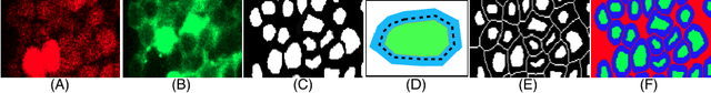 Figure 4 for Neuron Segmentation Using Deep Complete Bipartite Networks