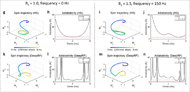 Figure 4 for DeepRF: Deep Reinforcement Learning Designed RadioFrequency Waveform in MRI