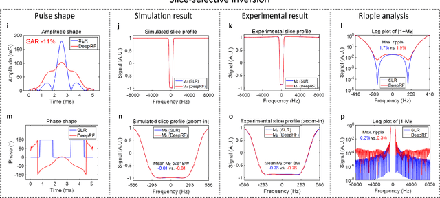 Figure 2 for DeepRF: Deep Reinforcement Learning Designed RadioFrequency Waveform in MRI
