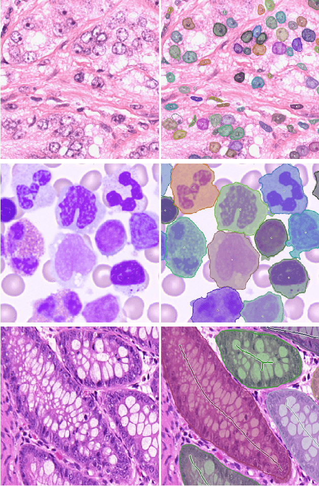 Figure 1 for NuClick: A Deep Learning Framework for Interactive Segmentation of Microscopy Images