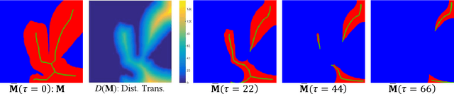 Figure 3 for NuClick: A Deep Learning Framework for Interactive Segmentation of Microscopy Images