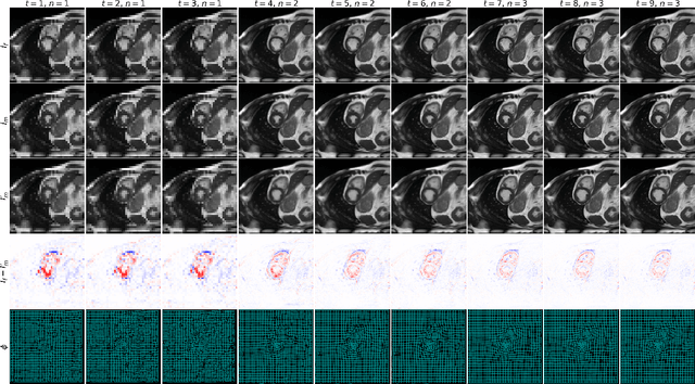 Figure 2 for GraDIRN: Learning Iterative Gradient Descent-based Energy Minimization for Deformable Image Registration