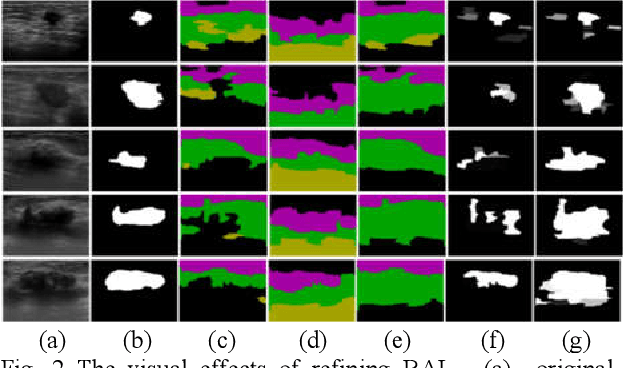 Figure 2 for Breast Anatomy Enriched Tumor Saliency Estimation