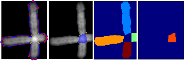 Figure 1 for Image Segmentation to Distinguish Between Overlapping Human Chromosomes