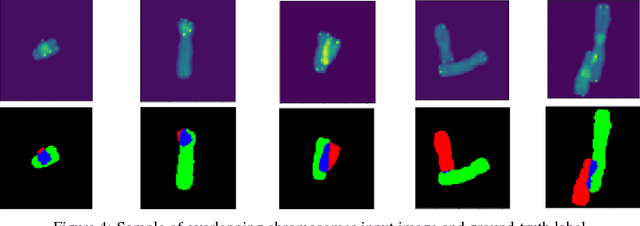 Figure 4 for Image Segmentation to Distinguish Between Overlapping Human Chromosomes