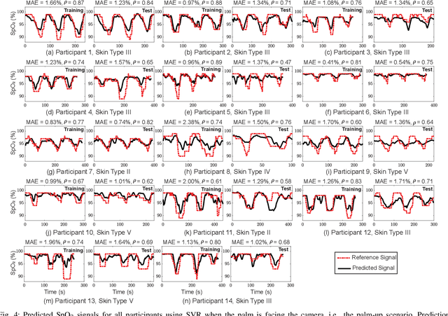 Figure 4 for A Multi-Channel Ratio-of-Ratios Method for Noncontact Hand Video Based SpO2 Monitoring Using Smartphone Cameras