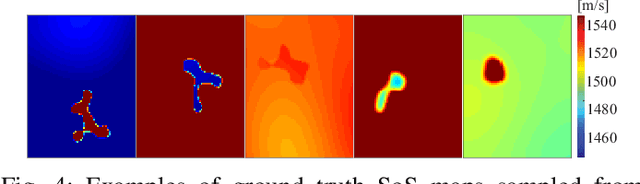 Figure 4 for Training Variational Networks with Multi-Domain Simulations: Speed-of-Sound Image Reconstruction