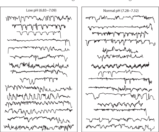 Figure 1 for Highly comparative fetal heart rate analysis