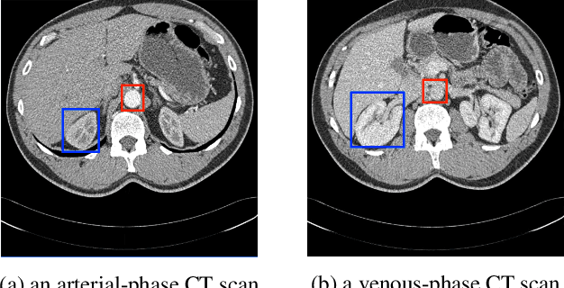 Figure 2 for Phase Collaborative Network for Multi-Phase Medical Imaging Segmentation