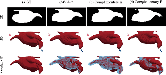 Figure 1 for Complementary consistency semi-supervised learning for 3D left atrial image segmentation