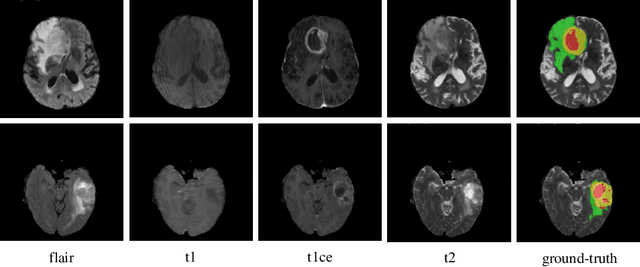 Figure 1 for HNF-Netv2 for Brain Tumor Segmentation using multi-modal MR Imaging