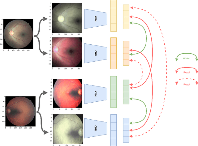 Figure 3 for Deep Semi-Supervised and Self-Supervised Learning for Diabetic Retinopathy Detection