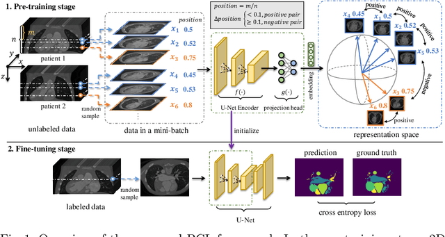 Figure 1 for Positional Contrastive Learning for Volumetric Medical Image Segmentation