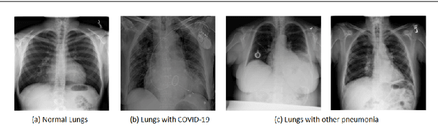 Figure 1 for Automated diagnosis of COVID-19 with limited posteroanterior chest X-ray images using fine-tuned deep neural networks