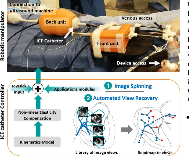 Figure 1 for Towards Automatic Manipulation of Intra-cardiac Echocardiography Catheter