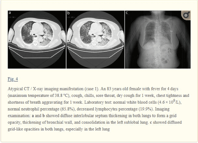 Figure 3 for COVID-19-CT-CXR: a freely accessible and weakly labeled chest X-ray and CT image collection on COVID-19 from biomedical literature