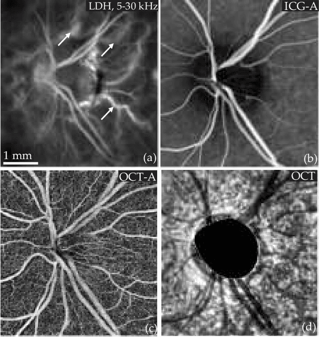 Figure 2 for Choroidal vasculature imaging with laser Doppler holography