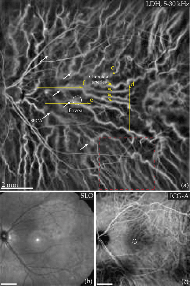 Figure 3 for Choroidal vasculature imaging with laser Doppler holography