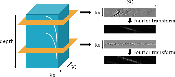 Figure 2 for Deep Learning for Accelerated Ultrasound Imaging