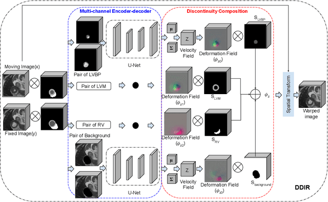 Figure 1 for A Deep Discontinuity-Preserving Image Registration Network