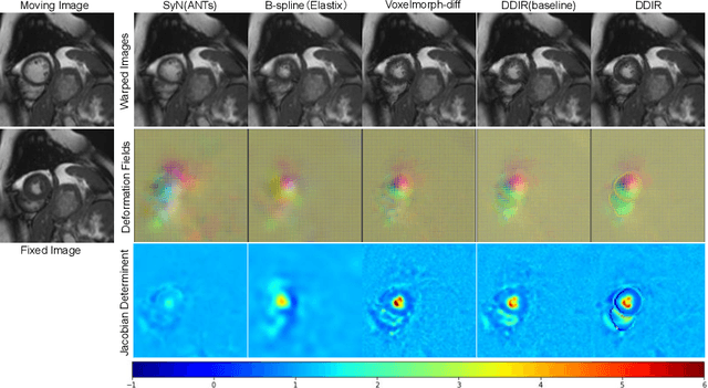 Figure 3 for A Deep Discontinuity-Preserving Image Registration Network