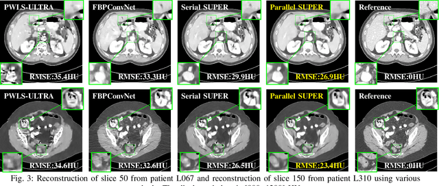 Figure 3 for Combining Deep Learning and Adaptive Sparse Modeling for Low-dose CT Reconstruction
