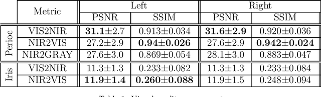 Figure 2 for Spectrum Translation for Cross-Spectral Ocular Matching