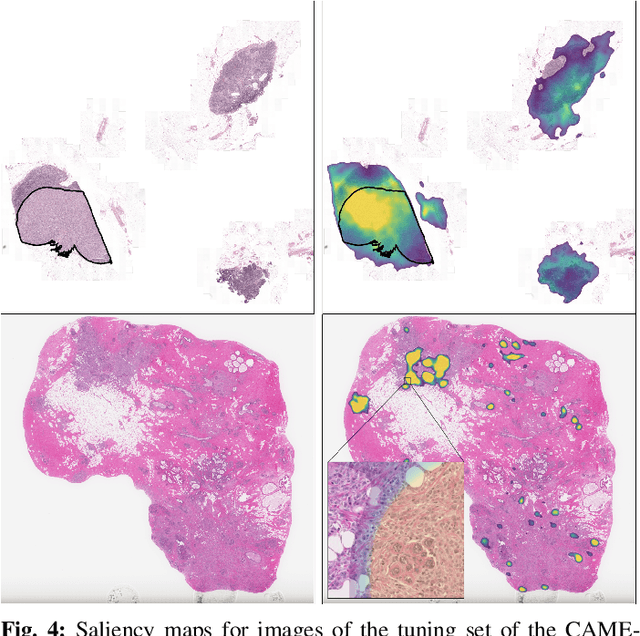 Figure 4 for Streaming convolutional neural networks for end-to-end learning with multi-megapixel images