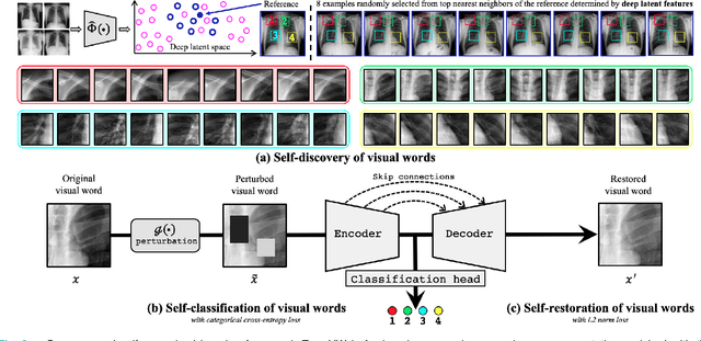 Figure 2 for Transferable Visual Words: Exploiting the Semantics of Anatomical Patterns for Self-supervised Learning
