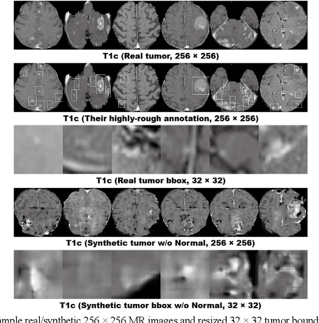 Figure 1 for Learning More with Less: GAN-based Medical Image Augmentation