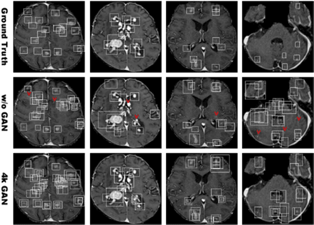 Figure 3 for Learning More with Less: GAN-based Medical Image Augmentation