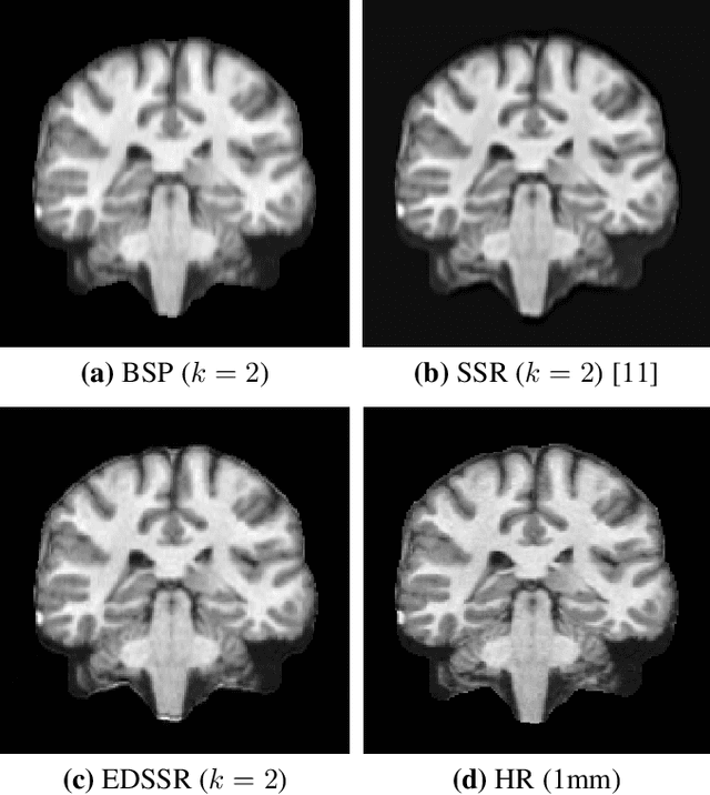 Figure 3 for Self Super-Resolution for Magnetic Resonance Images using Deep Networks