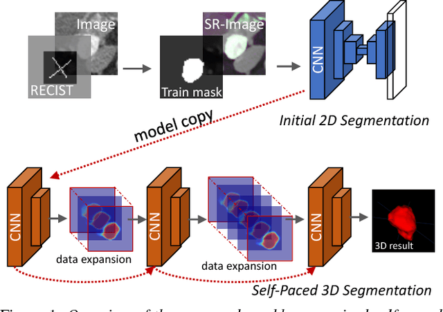 Figure 1 for Accurate Weakly Supervised Deep Lesion Segmentation on CT Scans: Self-Paced 3D Mask Generation from RECIST