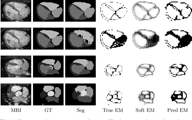 Figure 4 for A Fine-Grain Error Map Prediction and Segmentation Quality Assessment Framework for Whole-Heart Segmentation