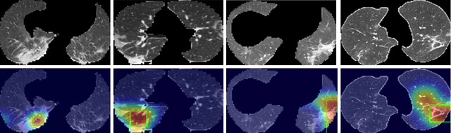 Figure 3 for Explainable AI For COVID-19 CT Classifiers: An Initial Comparison Study