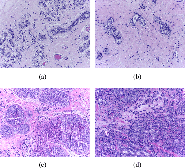 Figure 1 for A Comprehensive Review for Breast Histopathology Image Analysis Using Classical and Deep Neural Networks