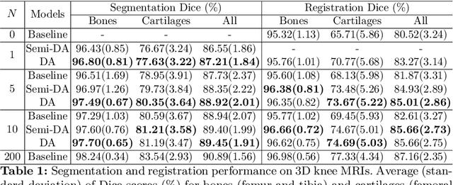 Figure 2 for DeepAtlas: Joint Semi-Supervised Learning of Image Registration and Segmentation