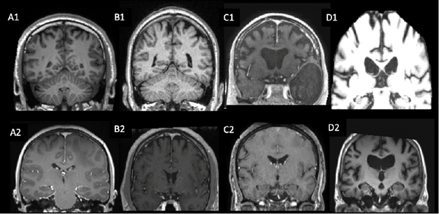 Figure 1 for Automatic quality control of brain T1-weighted magnetic resonance images for a clinical data warehouse