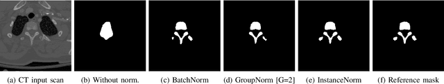 Figure 3 for Comparing Normalization Methods for Limited Batch Size Segmentation Neural Networks