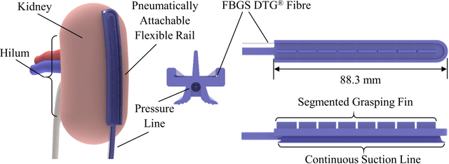 Figure 1 for Organ Shape Sensing using Pneumatically Attachable Flexible Rails in Robotic-Assisted Laparoscopic Surgery