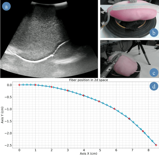 Figure 3 for Organ Shape Sensing using Pneumatically Attachable Flexible Rails in Robotic-Assisted Laparoscopic Surgery
