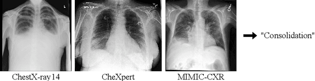 Figure 1 for Can we trust deep learning models diagnosis? The impact of domain shift in chest radiograph classification