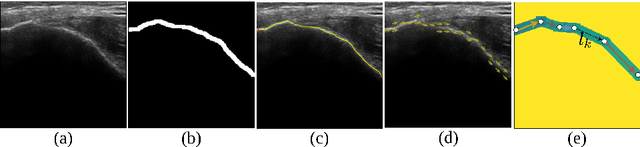 Figure 1 for Orientation-guided Graph Convolutional Network for Bone Surface Segmentation