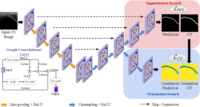 Figure 3 for Orientation-guided Graph Convolutional Network for Bone Surface Segmentation